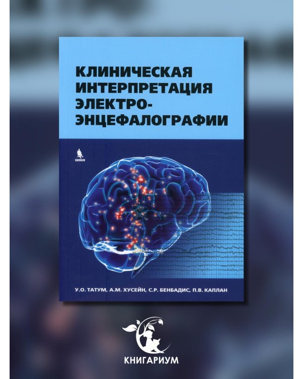 Клиническая интерпретация электроэнцефалографии