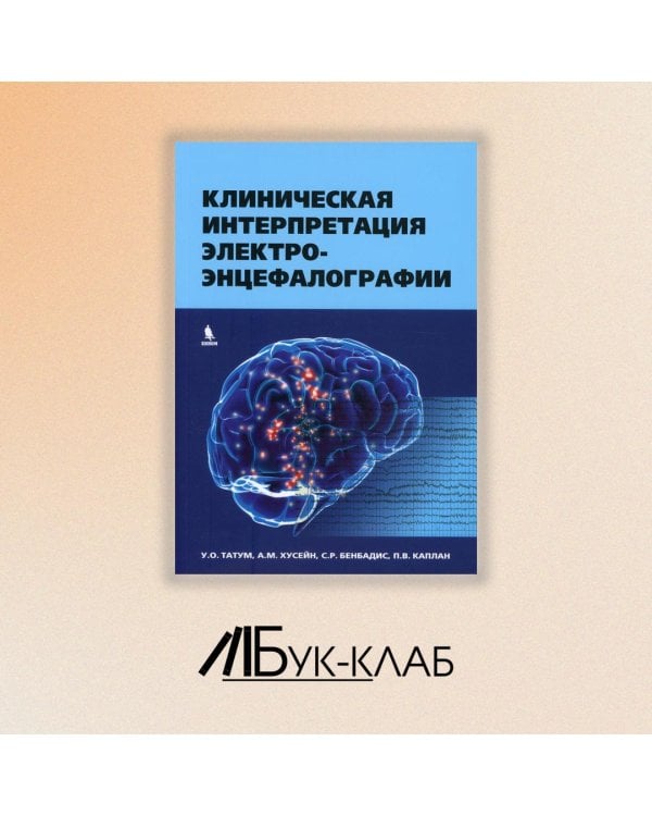 Клиническая интерпретация электроэнцефалографии
