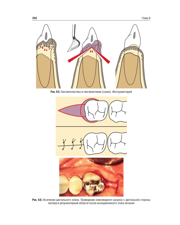 Хирургия полости рта: Учебник