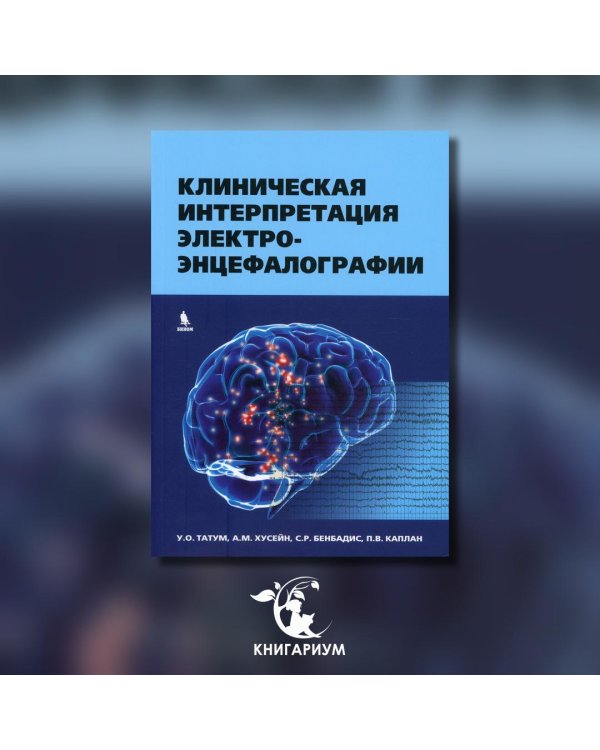 Клиническая интерпретация электроэнцефалографии
