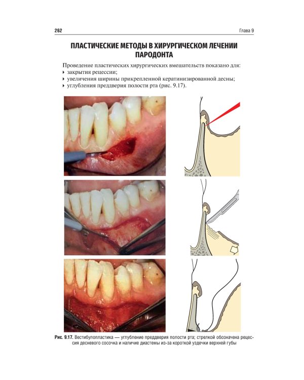 Хирургия полости рта: Учебник