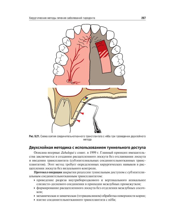 Хирургия полости рта: Учебник