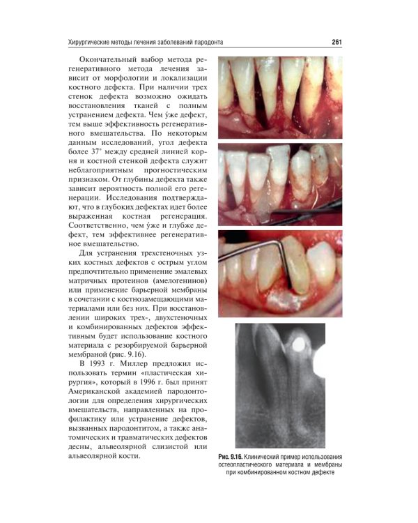 Хирургия полости рта: Учебник