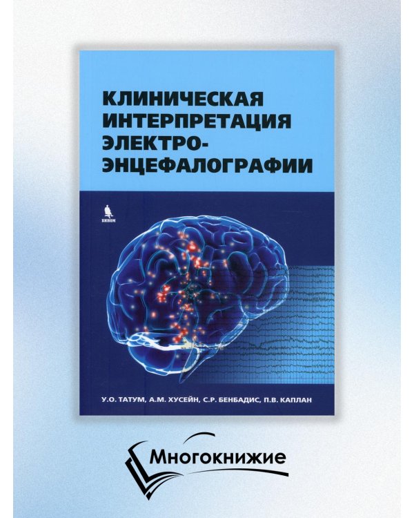 Клиническая интерпретация электроэнцефалографии