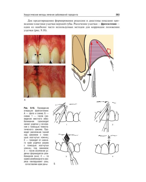 Хирургия полости рта: Учебник