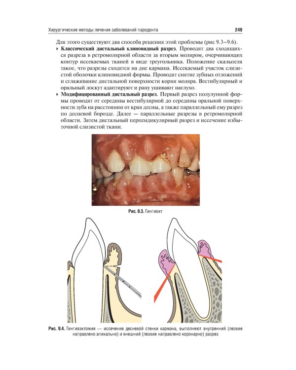 Хирургия полости рта: Учебник