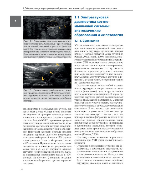 Ультразвуковая диагностика болезней костно-мышечной системы и инъекции под ультразвуковым контролем: практическое руководство. 2-е изд