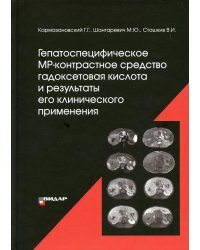 Гепатоспецифическое МР-контрастное средство «гадоксетовая кислота» и результаты его клинического применения"
