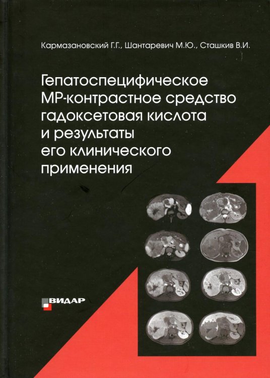 Гепатоспецифическое МР-контрастное средство «гадоксетовая кислота» и результаты его клинического применения"