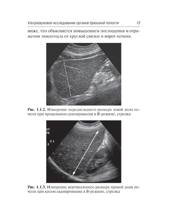 Ультразвуковая диагностика. 4-е изд., перераб