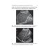 Карманные атласы по лучевой диагностике Ультразвуковая диагностика. 4-е изд., перераб