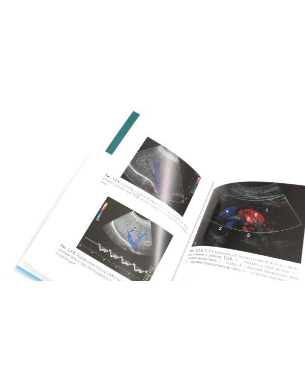 Ультразвуковая диагностика. 4-е изд., перераб