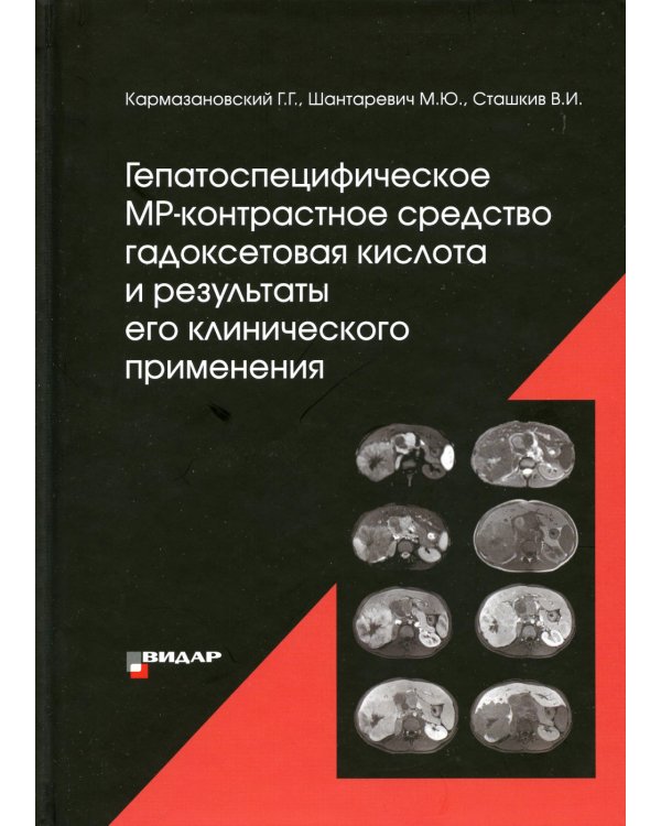 Гепатоспецифическое МР-контрастное средство «гадоксетовая кислота» и результаты его клинического применения"