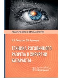 Техника роговичного разреза в хирургии катаракты