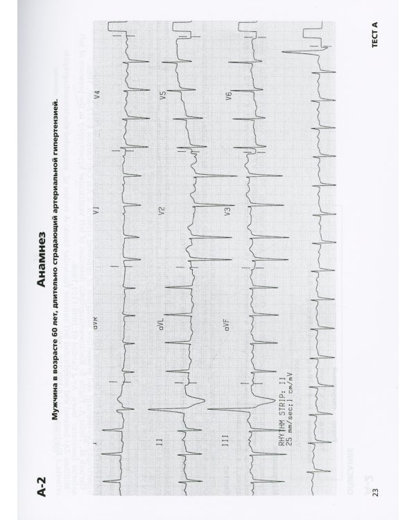 Клиническая электрокардиография. 2-е изд