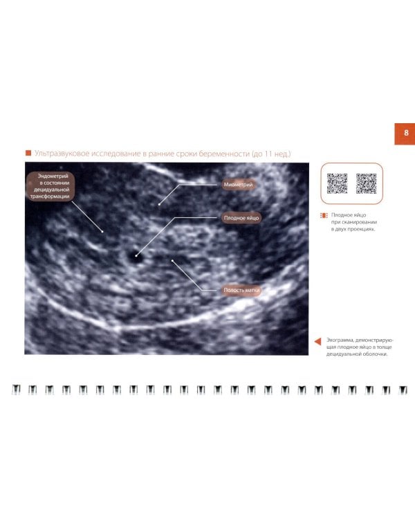 Атлас по ультразвуковой диагностике в акушерстве (эхограммы с комментариями): практическое пособие для врачей