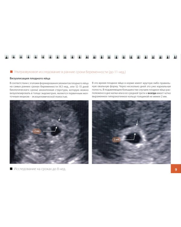 Атлас по ультразвуковой диагностике в акушерстве (эхограммы с комментариями): практическое пособие для врачей