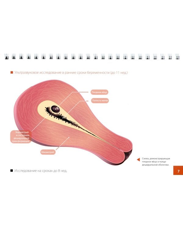 Атлас по ультразвуковой диагностике в акушерстве (эхограммы с комментариями): практическое пособие для врачей