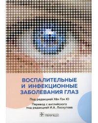 Воспалительные и инфекционные заболевания глаз