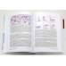 Хронический лимфолейкоз. Современная диагностика и лечение. 2-е изд., перераб. и доп