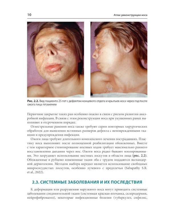 Атлас реконструкции носа