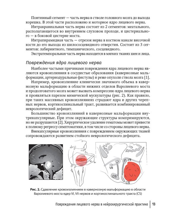 Лицевые нейропатии: от нейрохирургии до реабилитации: руководство для врачей