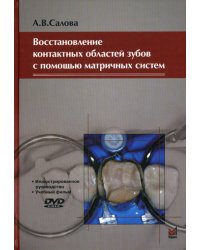 Восстановление контактных областей зубов с помощью матричных систем. 2-е изд., + CD