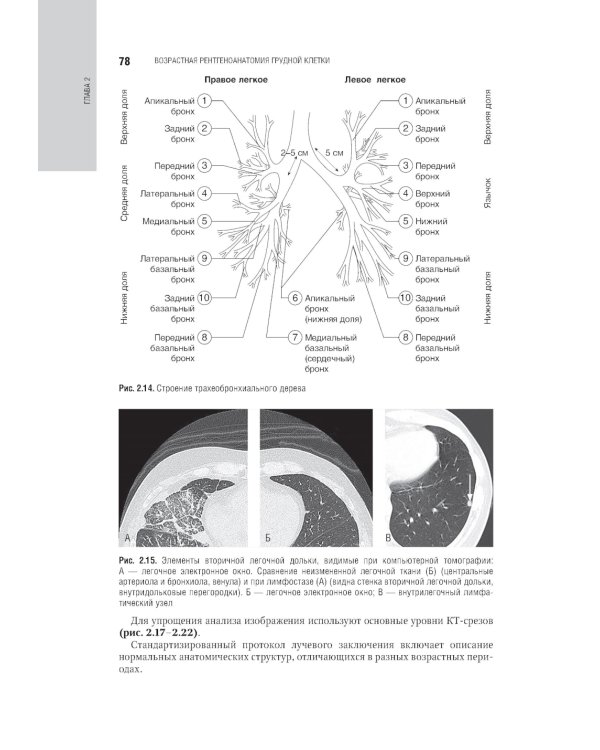 Лучевая диагностика органов грудной клетки: национальное руководство. 2-е изд., перераб. и доп