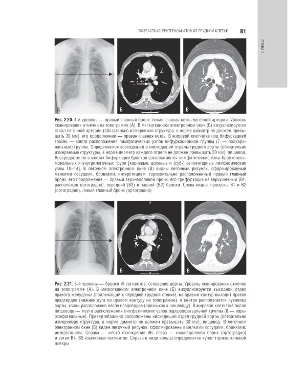 Лучевая диагностика органов грудной клетки: национальное руководство. 2-е изд., перераб. и доп