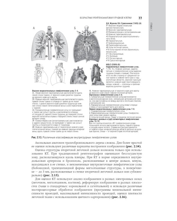Лучевая диагностика органов грудной клетки: национальное руководство. 2-е изд., перераб. и доп