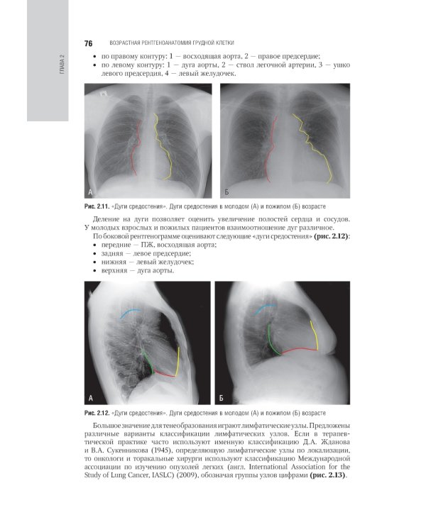 Лучевая диагностика органов грудной клетки: национальное руководство. 2-е изд., перераб. и доп