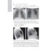 Лучевая диагностика органов грудной клетки: национальное руководство. 2-е изд., перераб. и доп