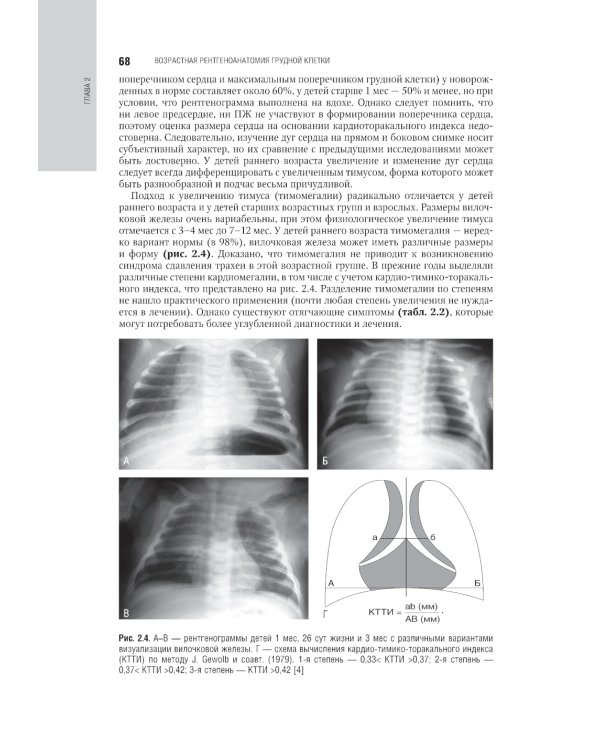 Лучевая диагностика органов грудной клетки: национальное руководство. 2-е изд., перераб. и доп