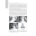 Лучевая диагностика органов грудной клетки: национальное руководство. 2-е изд., перераб. и доп