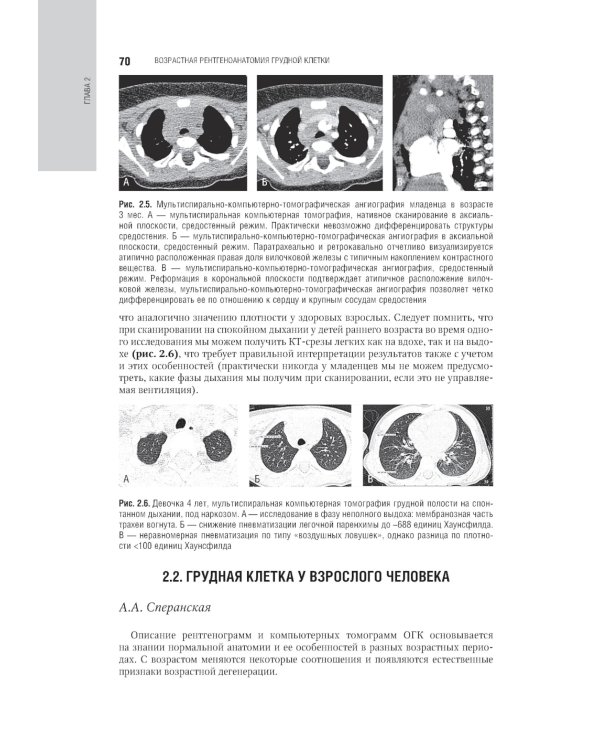 Лучевая диагностика органов грудной клетки: национальное руководство. 2-е изд., перераб. и доп