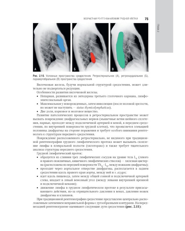 Лучевая диагностика органов грудной клетки: национальное руководство. 2-е изд., перераб. и доп