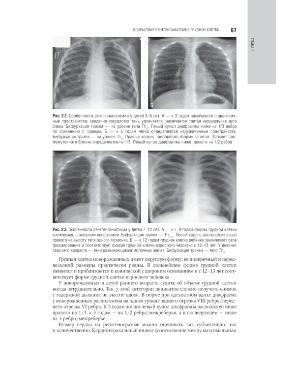 Лучевая диагностика органов грудной клетки: национальное руководство. 2-е изд., перераб. и доп