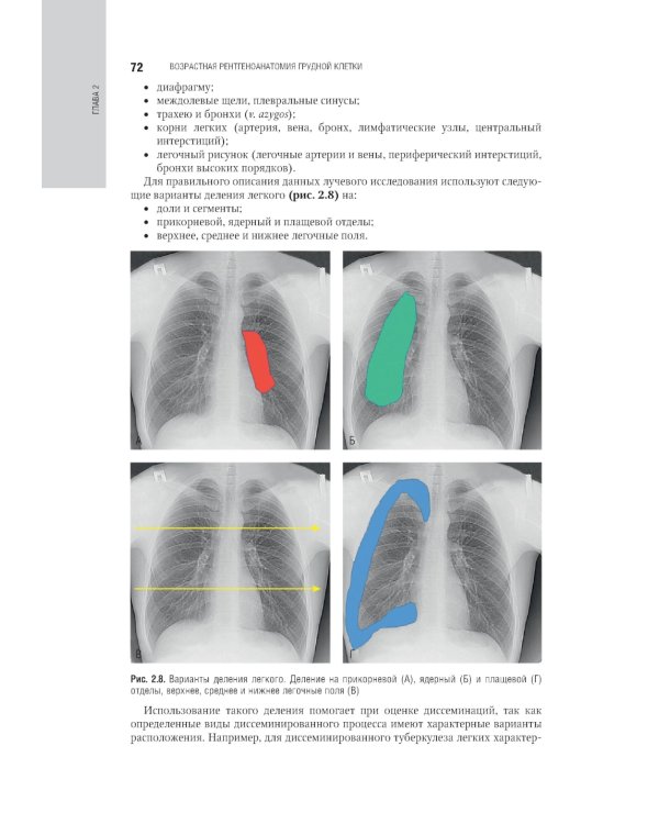 Лучевая диагностика органов грудной клетки: национальное руководство. 2-е изд., перераб. и доп