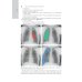 Лучевая диагностика органов грудной клетки: национальное руководство. 2-е изд., перераб. и доп