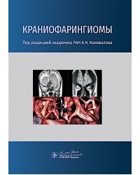 Краниофарингиомы