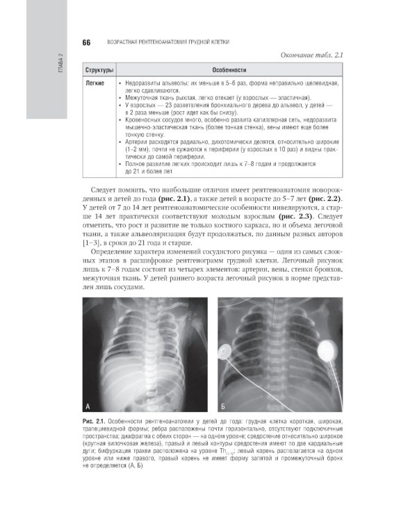 Лучевая диагностика органов грудной клетки: национальное руководство. 2-е изд., перераб. и доп