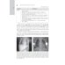 Лучевая диагностика органов грудной клетки: национальное руководство. 2-е изд., перераб. и доп