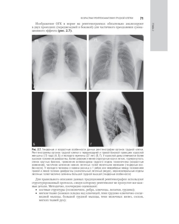 Лучевая диагностика органов грудной клетки: национальное руководство. 2-е изд., перераб. и доп