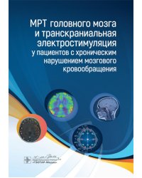 МРТ головного мозга и транскраниальная электростимуляция у пациентов с хроническим нарушением мозгового кровообращения