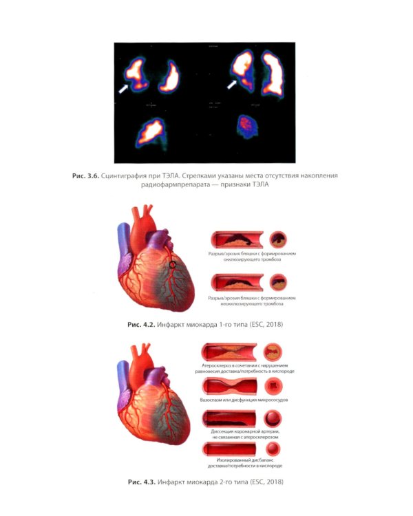 Внутренние болезни: дифференциальная диагностика и лечение: Учебник. 3-е изд., перераб. и доп