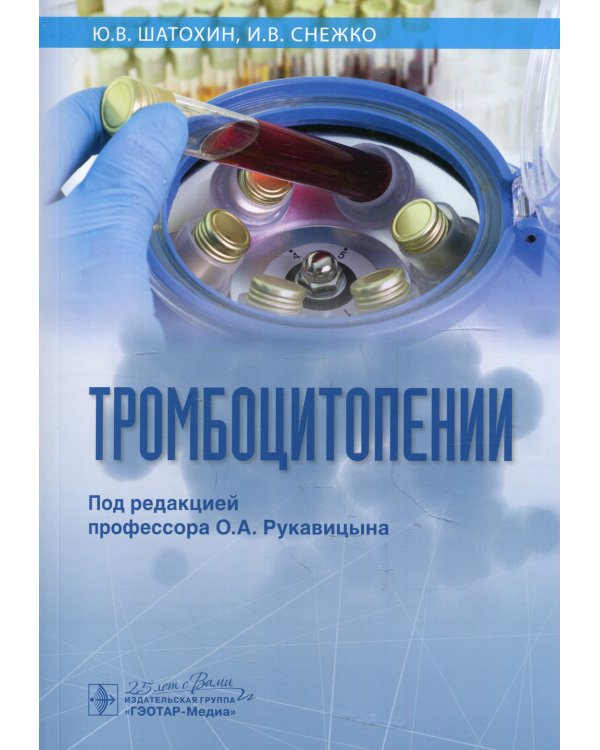 Тромбоцитопении