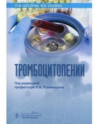 Тромбоцитопении