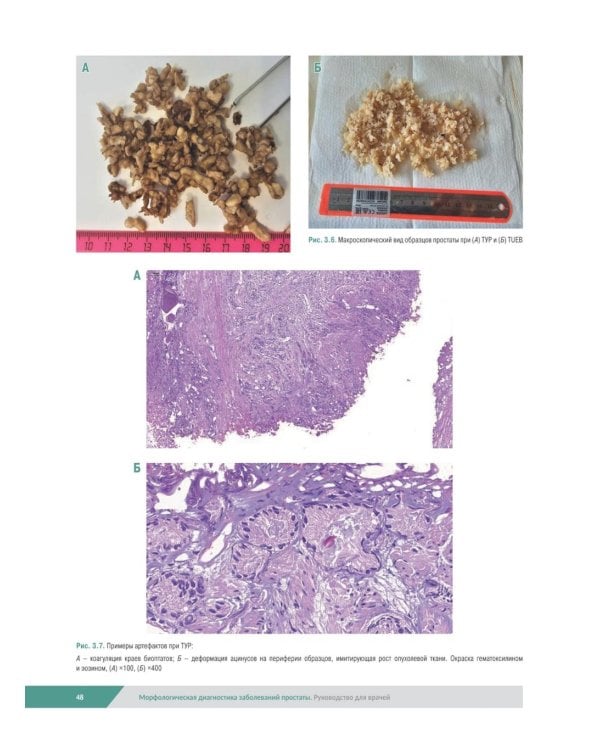 Морфологическая диагностика заболеваний простаты. Руководство для врачей