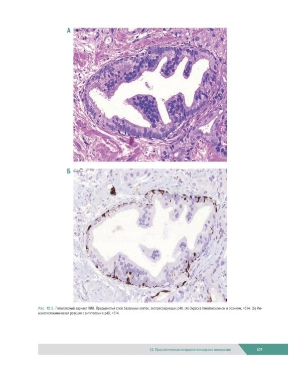Морфологическая диагностика заболеваний простаты. Руководство для врачей