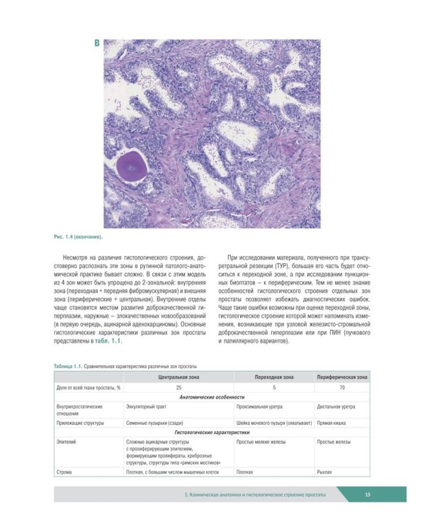 Морфологическая диагностика заболеваний простаты. Руководство для врачей